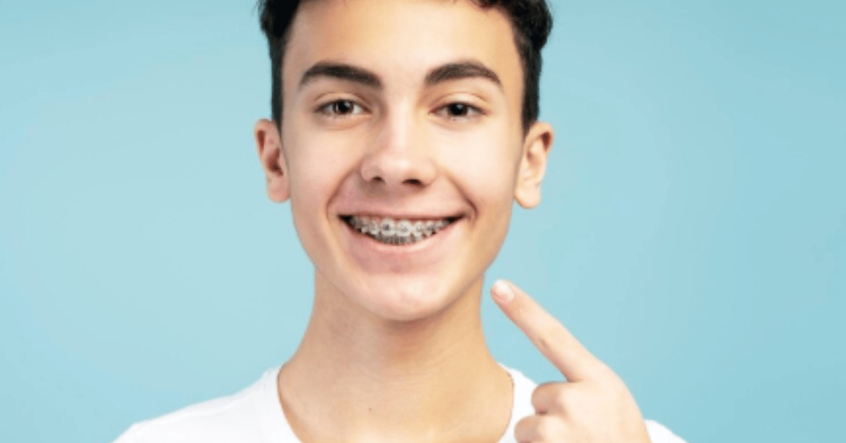 ceramic braces