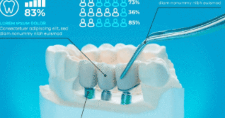 molar teeth implant