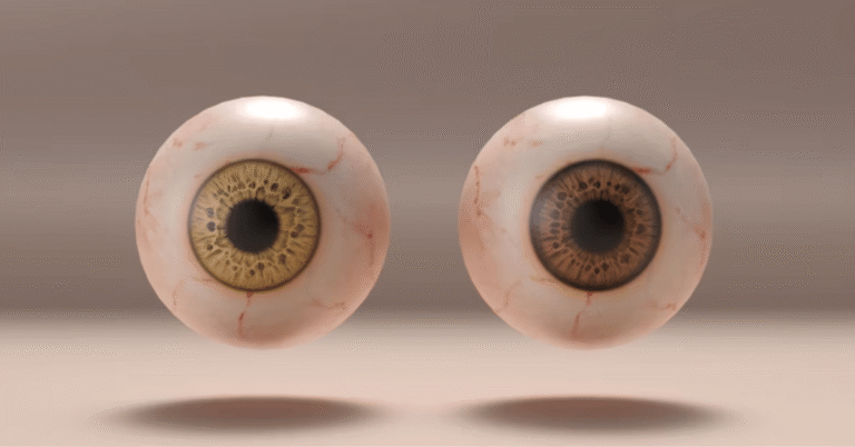 double eyeball