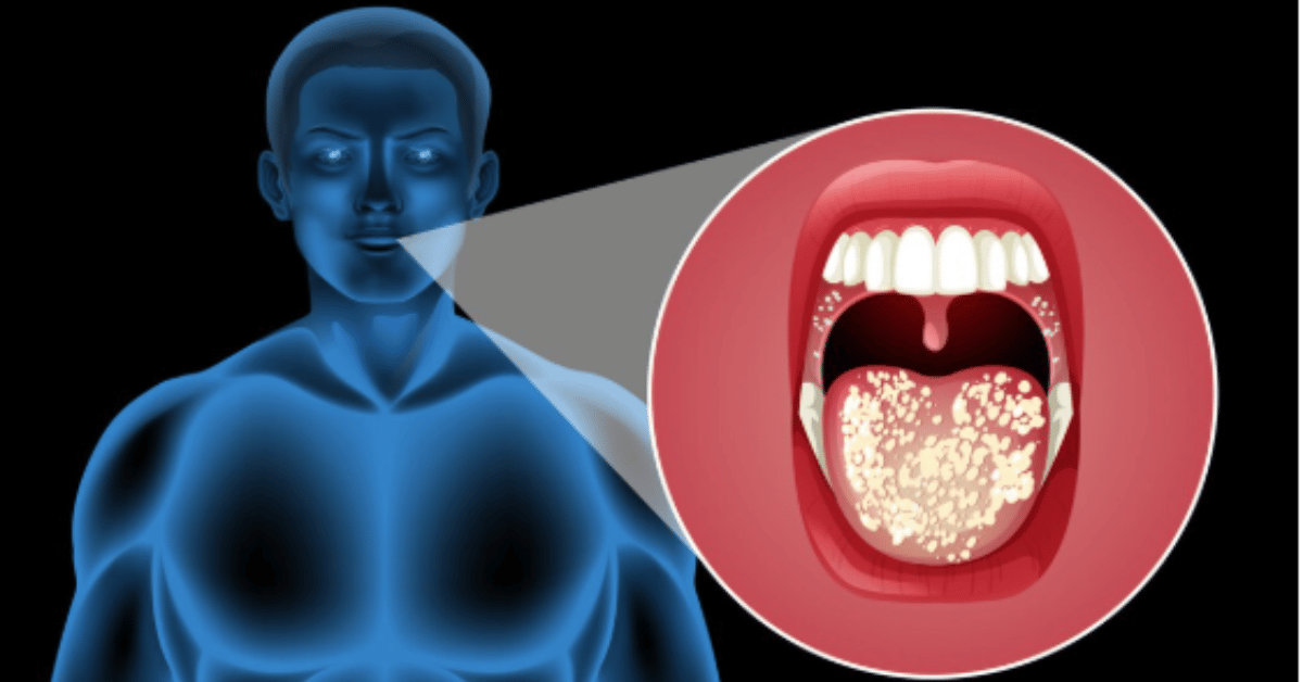 adenoidid